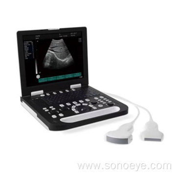 Full-digital Laptop Ultrasound Scanner